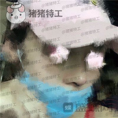 北京八大处,王欢,鼻修复,案例,价格,