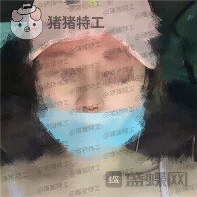 北京八大处,王欢,鼻修复,案例,价格,