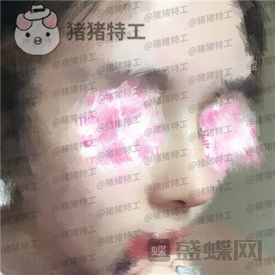 北京八大处,王欢,鼻修复,案例,价格,