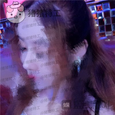 北京八大处,王欢,鼻修复,案例,价格,