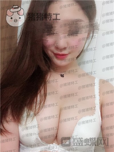 南京美贝尔,张永升,隆胸,案例,价格,