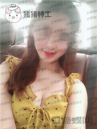 南京美贝尔,张永升,隆胸,案例,价格,