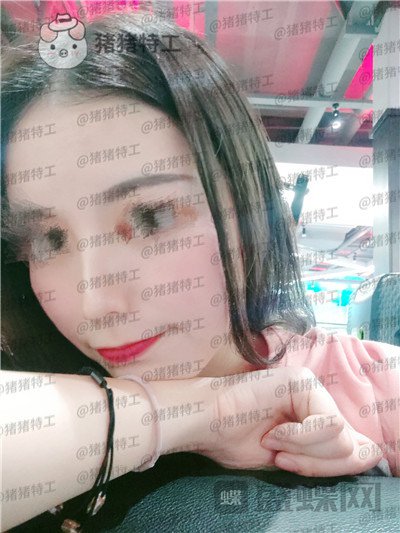 南京美贝尔,黄名斗,鼻部手术,案例,价格,