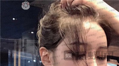 成都素美,杨迪,眼部手术,案例,价格,