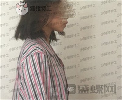 上海美贝尔,金关键,隆胸,案例,价格,