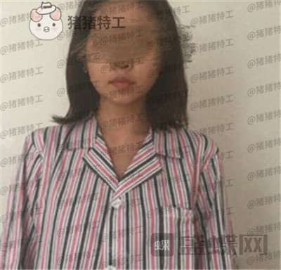 上海美贝尔,金关键,隆胸,案例,价格,