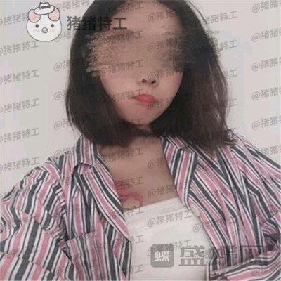 上海美贝尔,金关键,隆胸,案例,价格,