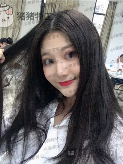 福州,爱美尔,黄振银,隆鼻,案例,价格,