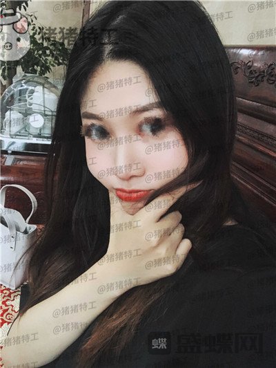 福州,爱美尔,黄振银,隆鼻,案例,价格,