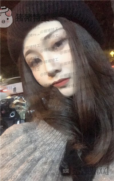 福州,爱美尔,黄振银,隆鼻,案例,价格,