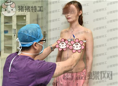 郑州集美,刘德辉,隆胸,案例,价格,