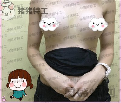 郑州集美,刘德辉,隆胸,案例,价格,