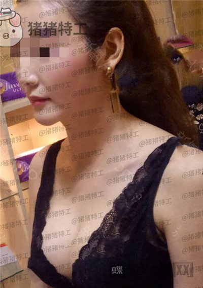 郑州集美,刘德辉,隆胸,案例,价格,