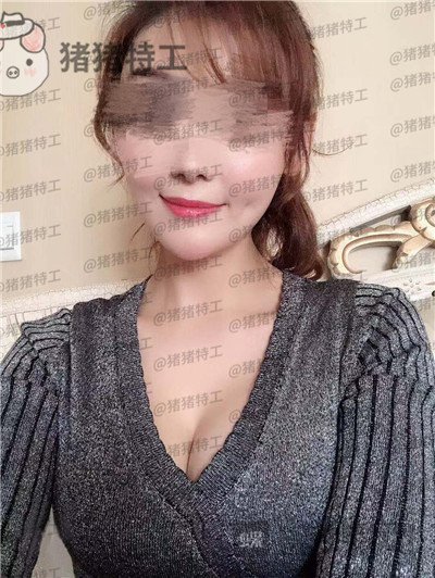 郑州集美,刘德辉,隆胸,案例,价格,