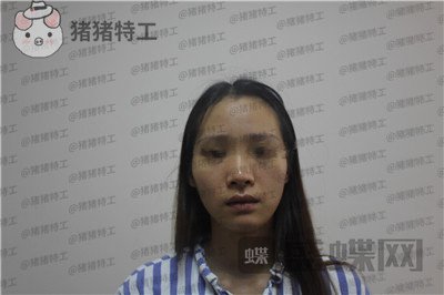 成都西区医院,毛健清,面部填充,案例,价格,