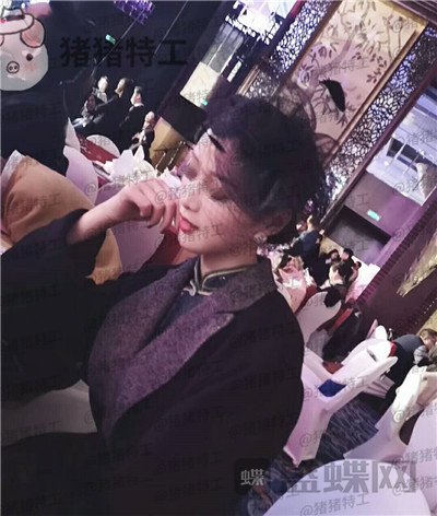 成都西区医院,毛健清,面部填充,案例,价格,