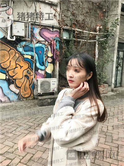 成都西区医院,毛健清,面部填充,案例,价格,