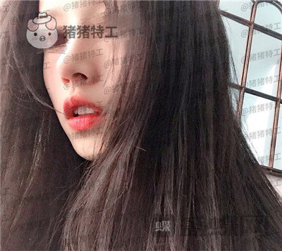 福州美贝尔,赵栋材,隆鼻,案例,价格,