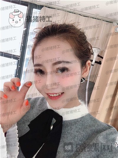 重庆当代,王旭明,鼻部手术,案例,价格,