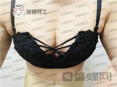 沧州华美,白伟枫,隆胸,案例,价格,