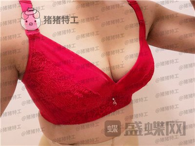 沧州华美,白伟枫,隆胸,案例,价格,