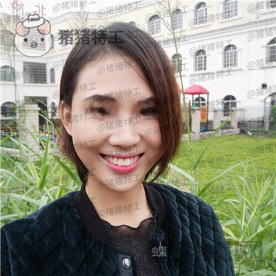 长沙美莱,斌,鼻部手术,案例,价格,