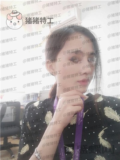 长沙美莱,斌,鼻部手术,案例,价格,
