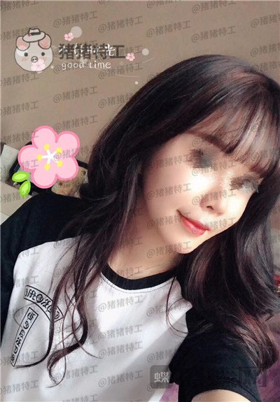 北京炫美,徐学东,垫鼻基底,案例,价格,