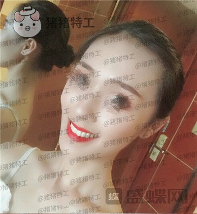 成都博爱,李竞男,牙齿美白,案例,价格,