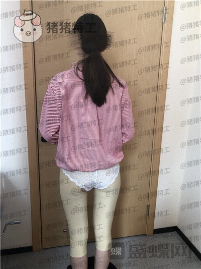 重庆瑞俪,胡小义,吸脂,案例,价格,