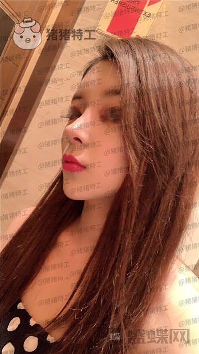 成都西区医院,肖凌,鼻修复,案例,价格,
