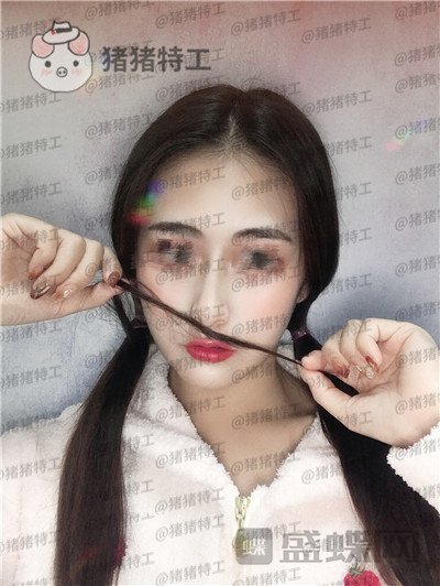 南京美贝尔,黄名斗,面部填充,案例,价格,南京美贝尔,黄名斗,面部填充,案例,价格,
