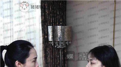 武汉美基元,,双眼皮,案例,价格,