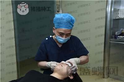 武汉美基元,,双眼皮,案例,价格,