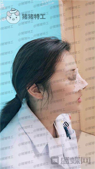 南京华韩奇致,裴柄万,隆鼻,案例,价格,