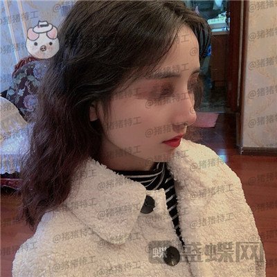 重庆铂生,杜亚旭,隆鼻,案例,价格,