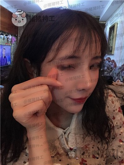 重庆铂生,杜亚旭,隆鼻,案例,价格,