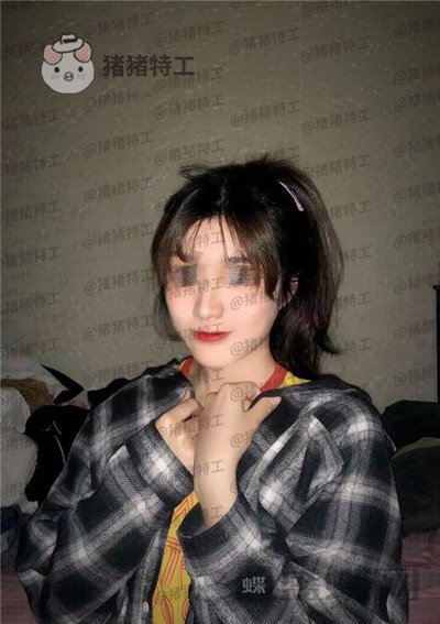 上海愉悦美联臣,陈红梅,面部填充,案例,价格,