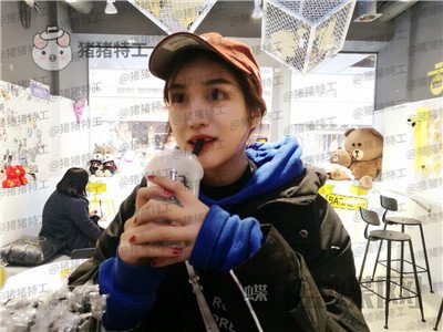 上海愉悦美联臣,陈红梅,面部填充,案例,价格,