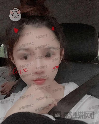 福州星龄,黎护忠,面部填充,案例,价格,