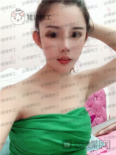 福州星龄,黎护忠,面部填充,案例,价格,