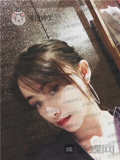 广州美莱,张毓,面部填充,案例,价格,