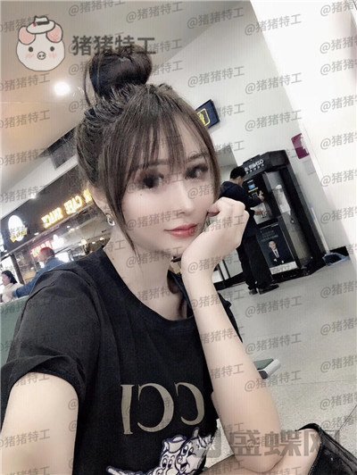 成都西区医院,肖凌,鼻部手术,案例,价格,