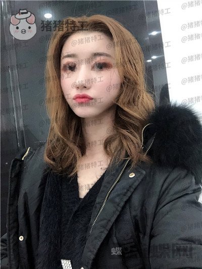 青岛诺德,姜留刚,面部填充,案例,价格,