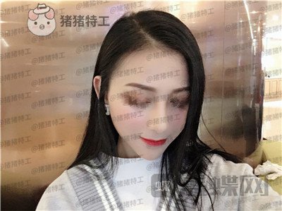 广州曙光,蒋思军,隆鼻,案例,价格,