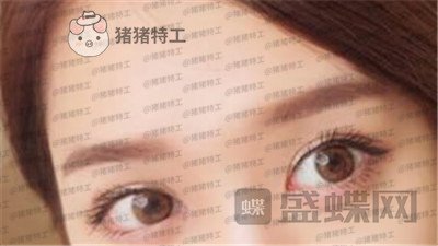 重庆美仑美奂,董祥宁,双眼皮,案例,价格,