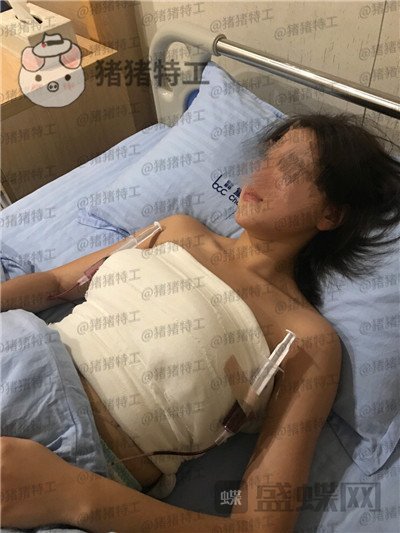 重庆联合丽格,党宁,隆胸,案例,价格,