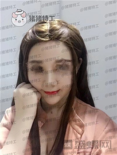 重庆中民,孙刚,隆鼻,案例,价格,