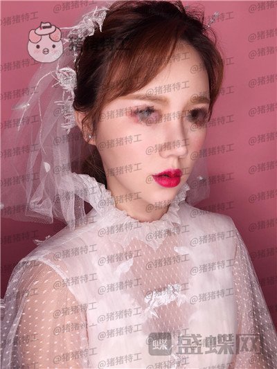 重庆中民,孙刚,隆鼻,案例,价格,