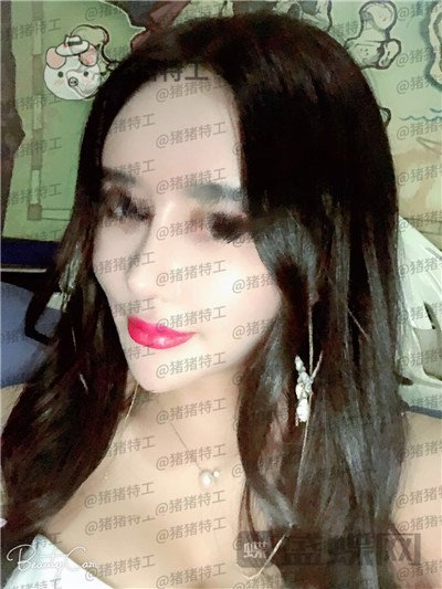 上海喜美,王会勇,隆鼻,鼻修复,案例,价格,